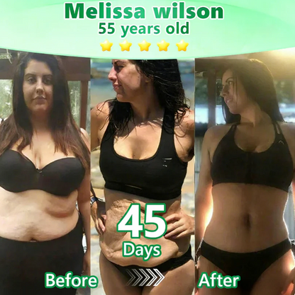 𝑶𝒇𝒇𝒊𝒄𝒊𝒂𝒍 𝑺𝒕𝒐𝒓𝒆  |🌿🌿𝐆𝐋𝐎𝑹𝑬𝑵𝑫𝗔®𝑴𝒐𝒓𝒊𝒏𝒈𝗮 · 𝗕𝗲𝗿𝗯𝗲𝗿𝙞𝙣𝙚 × 𝙉𝘼𝐃+ 𝟏𝟎-𝐢𝐧-𝟏 𝗔𝗱𝘃𝗮𝗻𝗰𝙚𝙙 𝙉𝙖𝙣𝙤 𝙈𝙞𝙘𝙧𝙤𝙣𝙚𝙚𝐝𝐥𝐞 𝐏𝐚𝐭𝙘𝙝🇺🇸(𝐉𝐮𝐬𝐭 𝐨𝐧𝐜𝐞 𝐚 𝐝𝐚𝐲, 𝐯𝐢𝐬𝐢𝐛𝐥𝐞 𝐜𝐡𝐚𝐧𝐠𝐞𝐬 𝐢𝐧 𝟕 𝐝𝐚𝐲𝐬） ✅ 𝐅𝐨𝐫 𝐨𝐛𝐞𝐬𝐢𝐭𝐲, 🅛🅞🅞🅢🅔 🅢🅚🅘🅝,𝐝𝐢𝐚𝐛𝐞𝐭𝐞𝐬, 𝐬𝐥𝐞𝐞𝐩 𝐚𝐩𝐧𝐞𝐚, 𝐣𝐨𝐢𝐧𝐭 𝐢𝐬𝐬𝐮𝐞𝐬, 𝐚𝐧𝐝 𝐦𝐨𝐫𝐞